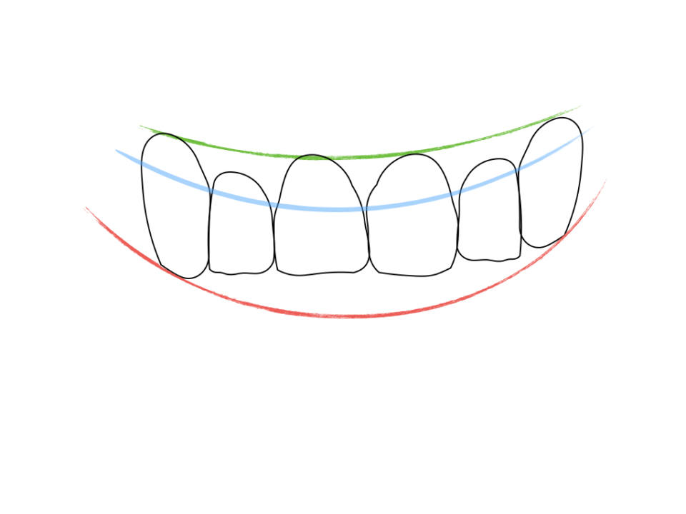 diseno-de-la-sonrisa-foto-1