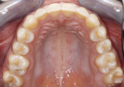 ortodoncia-y-odontopediatria-caso-3-foto-2