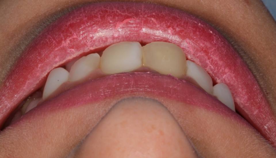 ortodoncia-y-odontopediatria-caso-7-foto-4