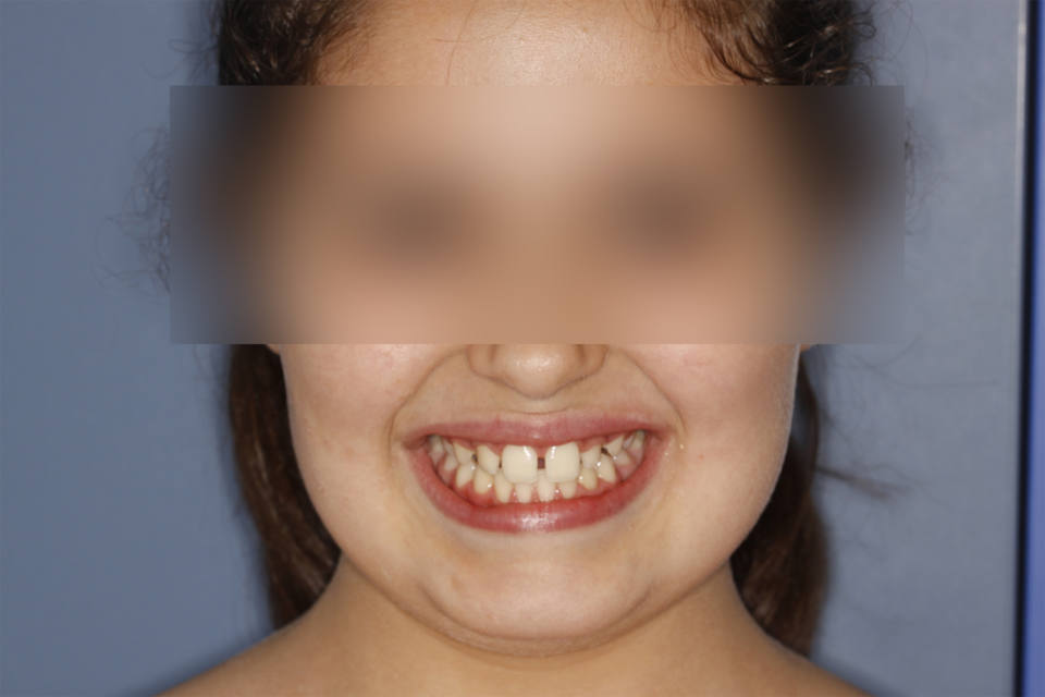 ortodoncia-y-odontopediatria-caso-9-foto-2