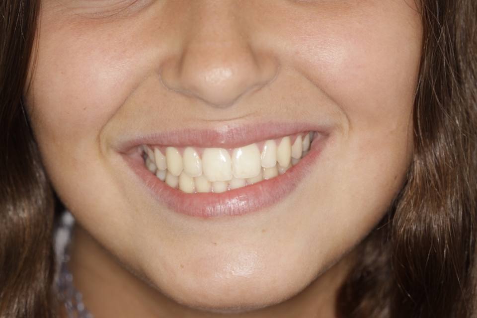 ortodoncia-y-odontopediatria-caso-9-foto-3